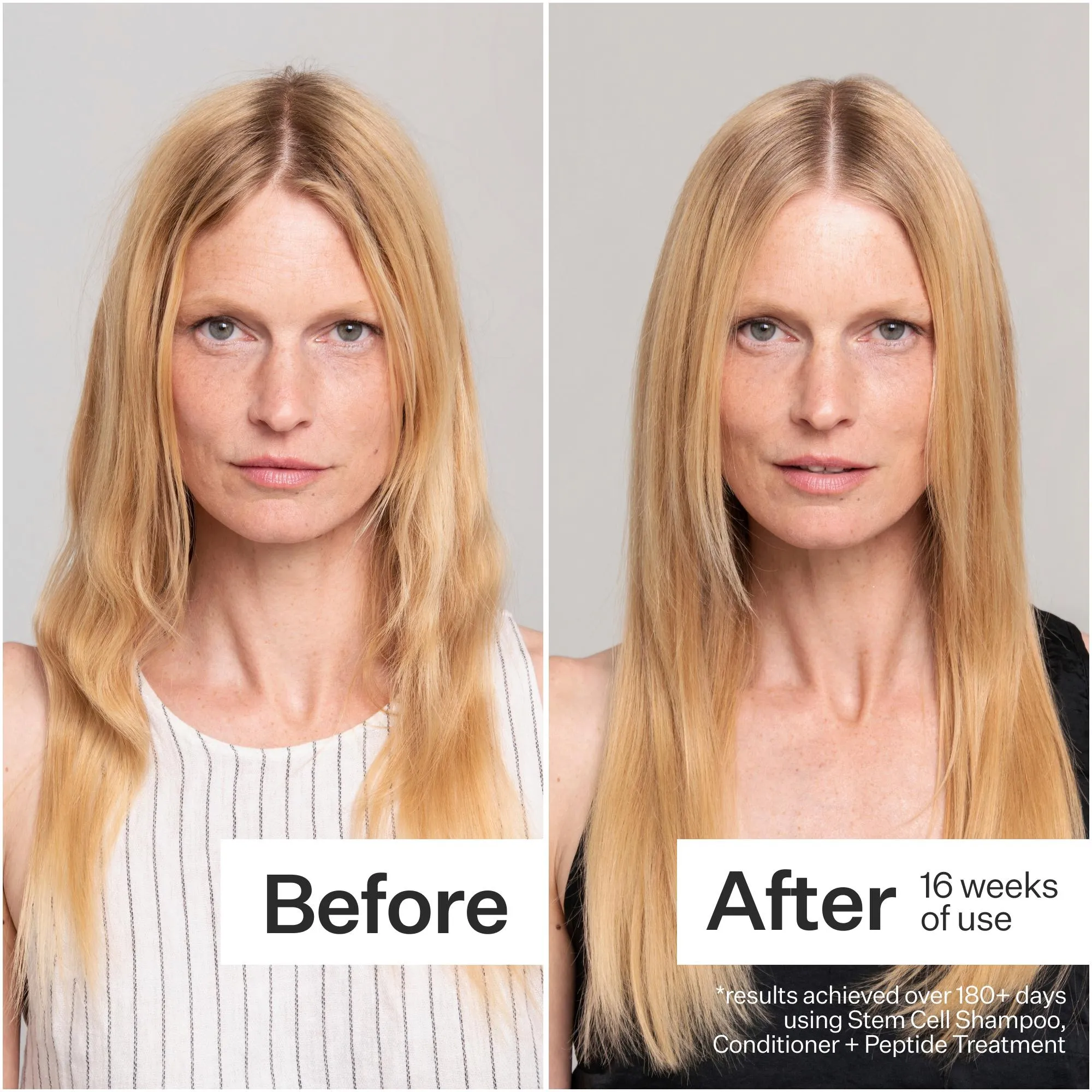 Act Acre Stem Cell Conditioner